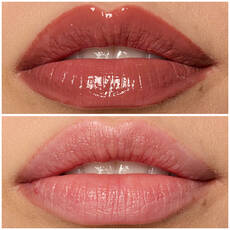 Labios de modelo usando Lip I.V. 02 Hydra-Honey.