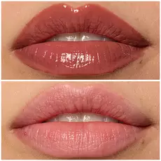 Labios de modelo usando Lip I.V. 02 Hydra-Honey.